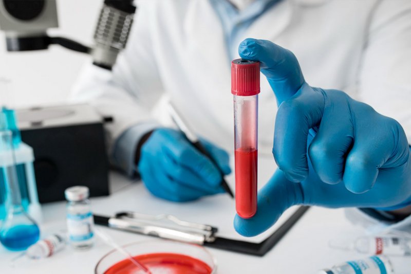 Exames Laboratoriais