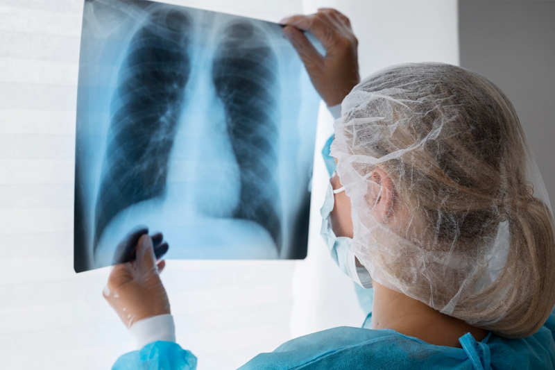 Radiografia ou Raio-X